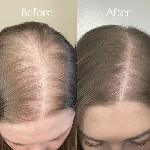 RevivRoot™ Restoring Shampoo
