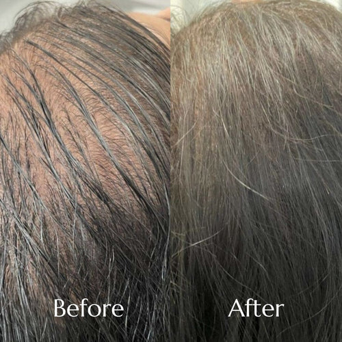 RevivRoot™ Restoring Shampoo