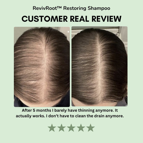 RevivRoot™ Restoring Shampoo